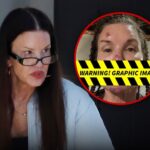 janice dickinson spotted after sharing alleged injuries from reality show fall 696c361a7ce0e
