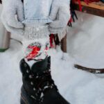 remedii naturale pentru degeraturi cum sa le folosesti corect 696a0accac9df