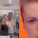 imagini socante cu modelul agresat de iubit tanara de 33 de ani a suferit o interventie pe creier dupa atacul violent 698f8e3912679