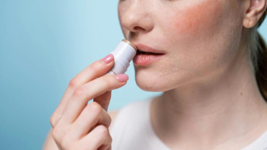 remedii naturiste pentru buze uscate si maini crapate care sunt cauzele si solutiile conform specialistilor 69807ed621287