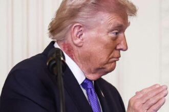 misterul petei rosii a lui trump descifrat de medici cat timp va purta liderul american semnele iritatiei de pe gat 69a60700d69fb